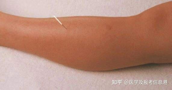 天枢穴、关元穴、上巨虚穴,治疗肠道疾病首选穴位 - 知乎