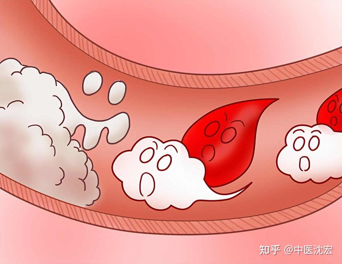 脾肾阳虚怎么办?早上附子理中丸,晚上桂附地黄丸 把阳气补到根 - 知乎