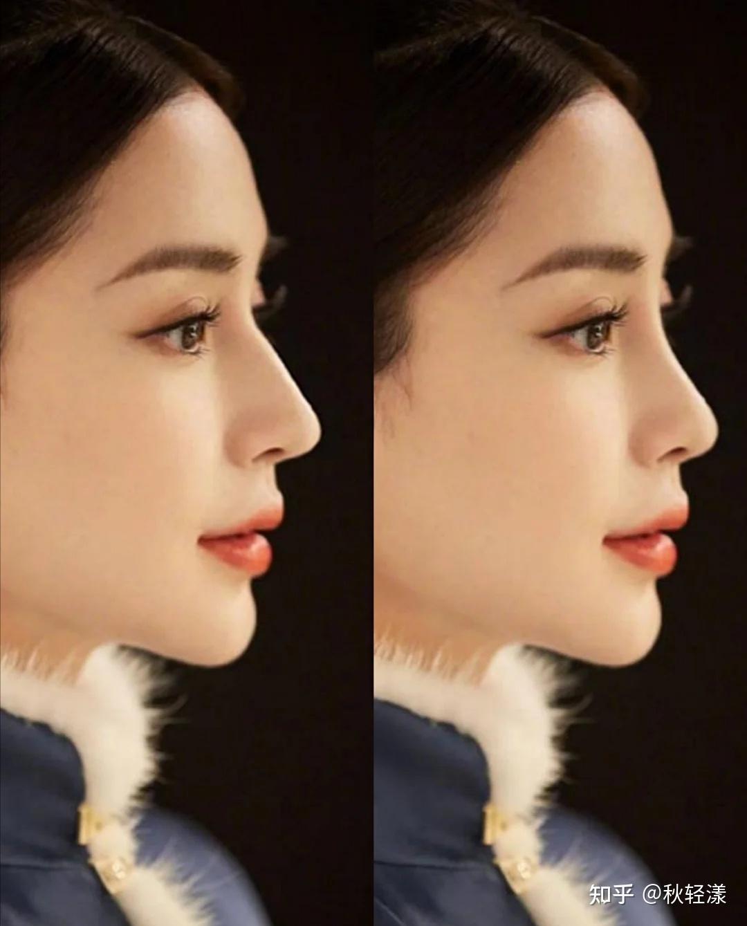 颜值高的女孩子都有高鼻梁吗