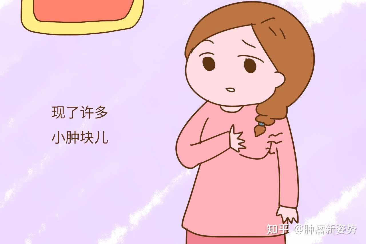 普通溼疹和溼疹樣乳腺癌有什麼區別? - 知乎