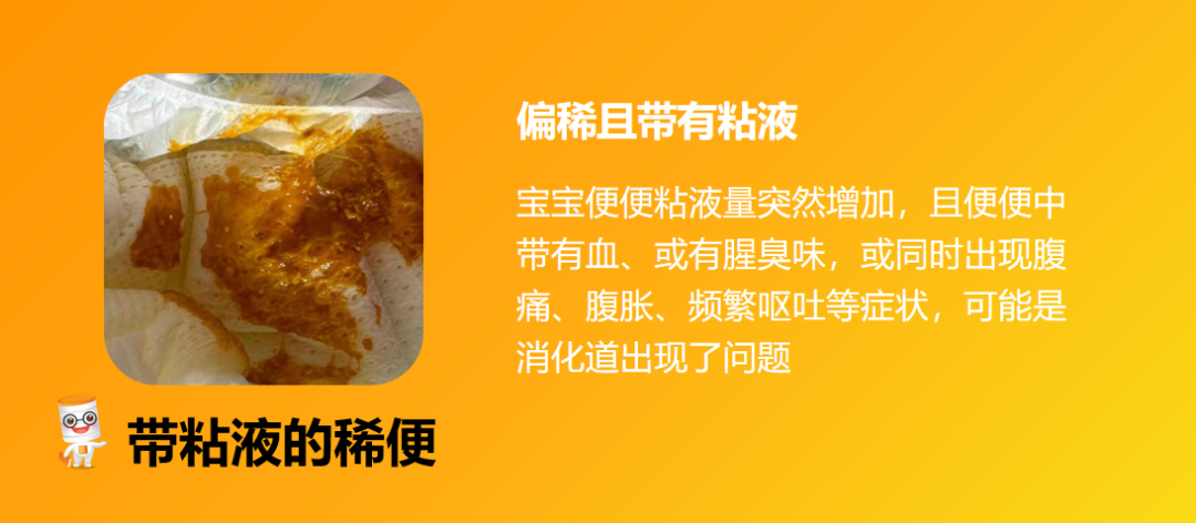 别焦虑!60+宝宝便便图,教你准确识“便” - 知乎