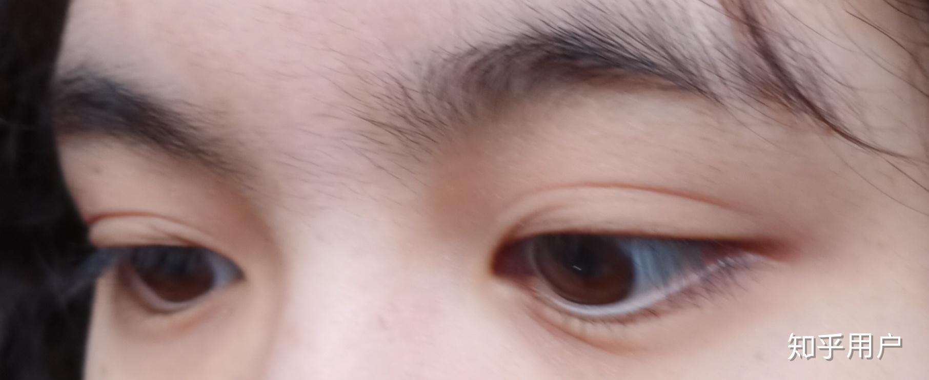 什么是蒙古褶? - 知乎