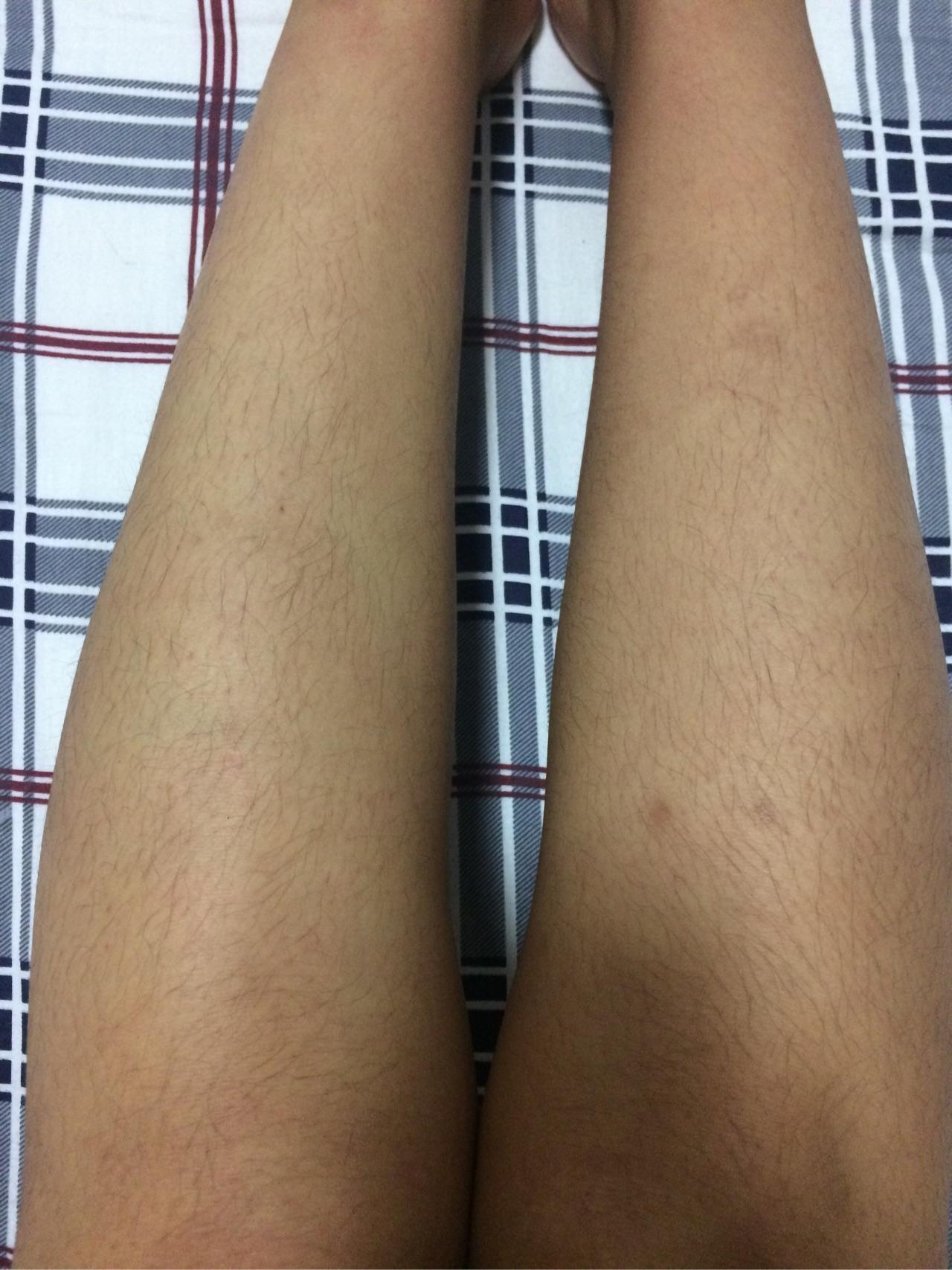 女生腿毛旺盛是怎样的人生体验