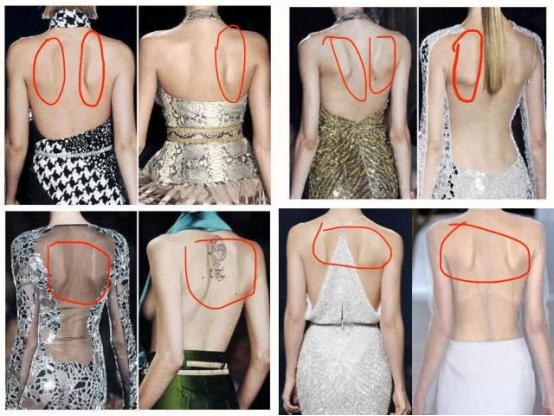 没有高低肩但肩胛骨一侧突出是怎么回事? - 知乎