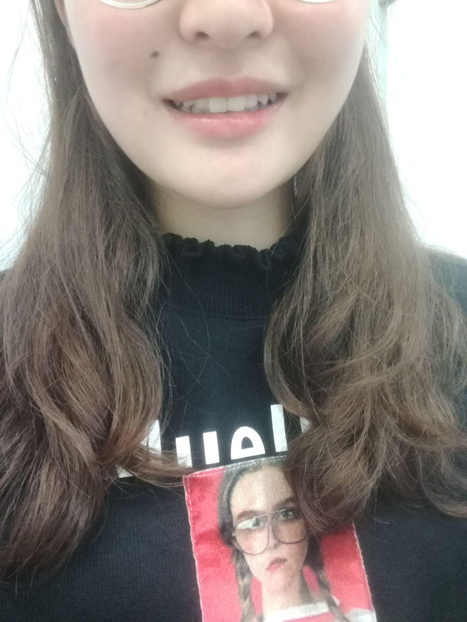 这样的牙齿咬合正常吗,我觉得自己的上颌有点突出,笑起来也露不出牙齿