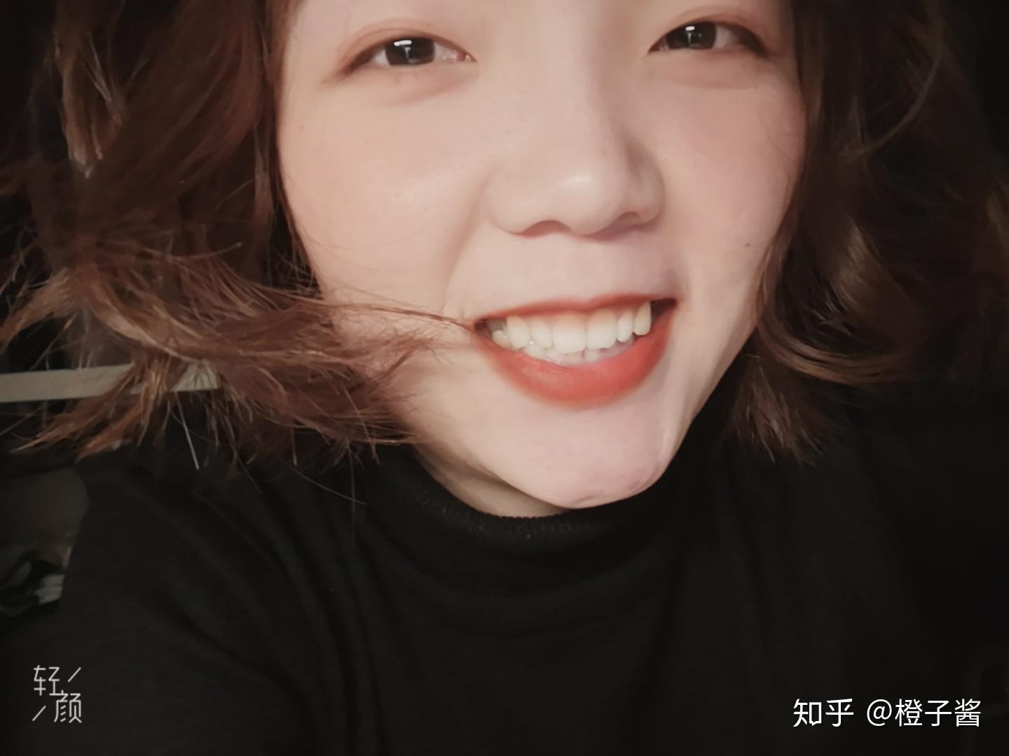 瞳孔很小眼眶却很大戴不戴美瞳区别很大即将订婚了怕未来老公看到自己