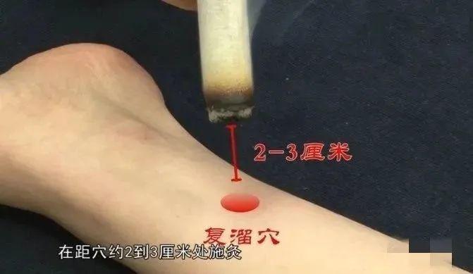 补虚止汗用两穴,特别适合夏三月~ - 知乎