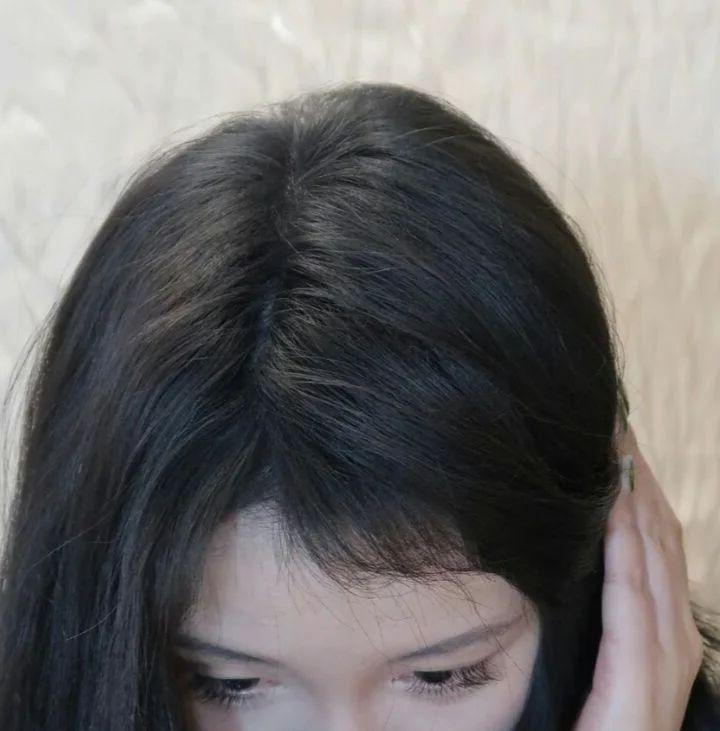 如何使发量变多?真正能提升发量的方法是什么? - 知乎