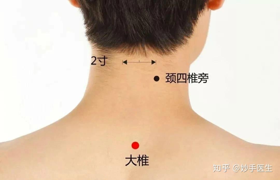 三伏灸的全身穴位图,请收藏! - 知乎