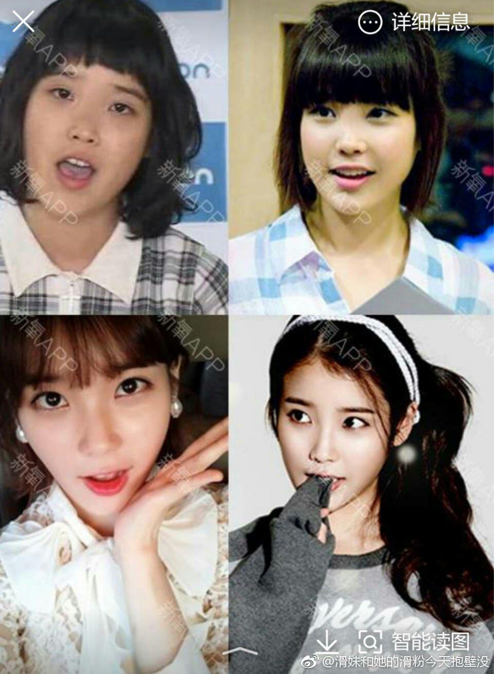 韩国有哪些明星做了明显的整容