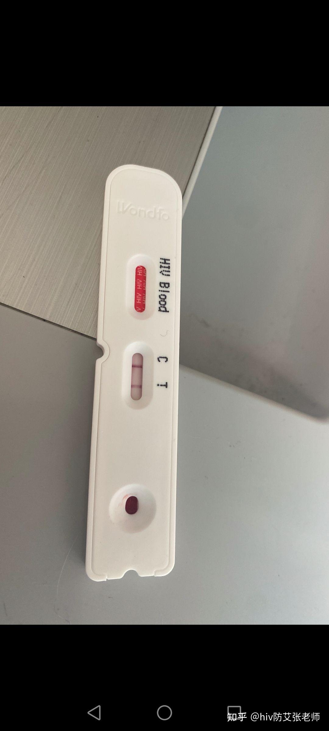 麻烦各位大佬看一下这是包埋线吗?