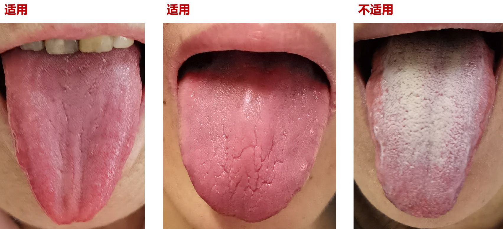 每天喝2升水还是嘴巴发干该怎么办