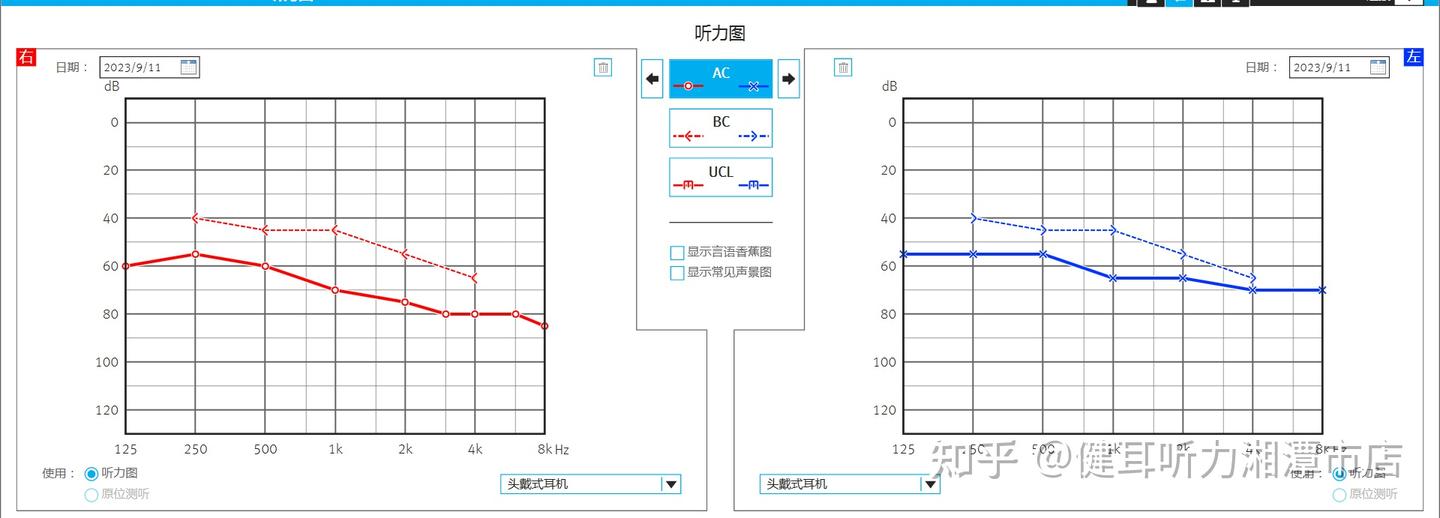 90岁的爷爷反馈--我也想听得好 - 知乎