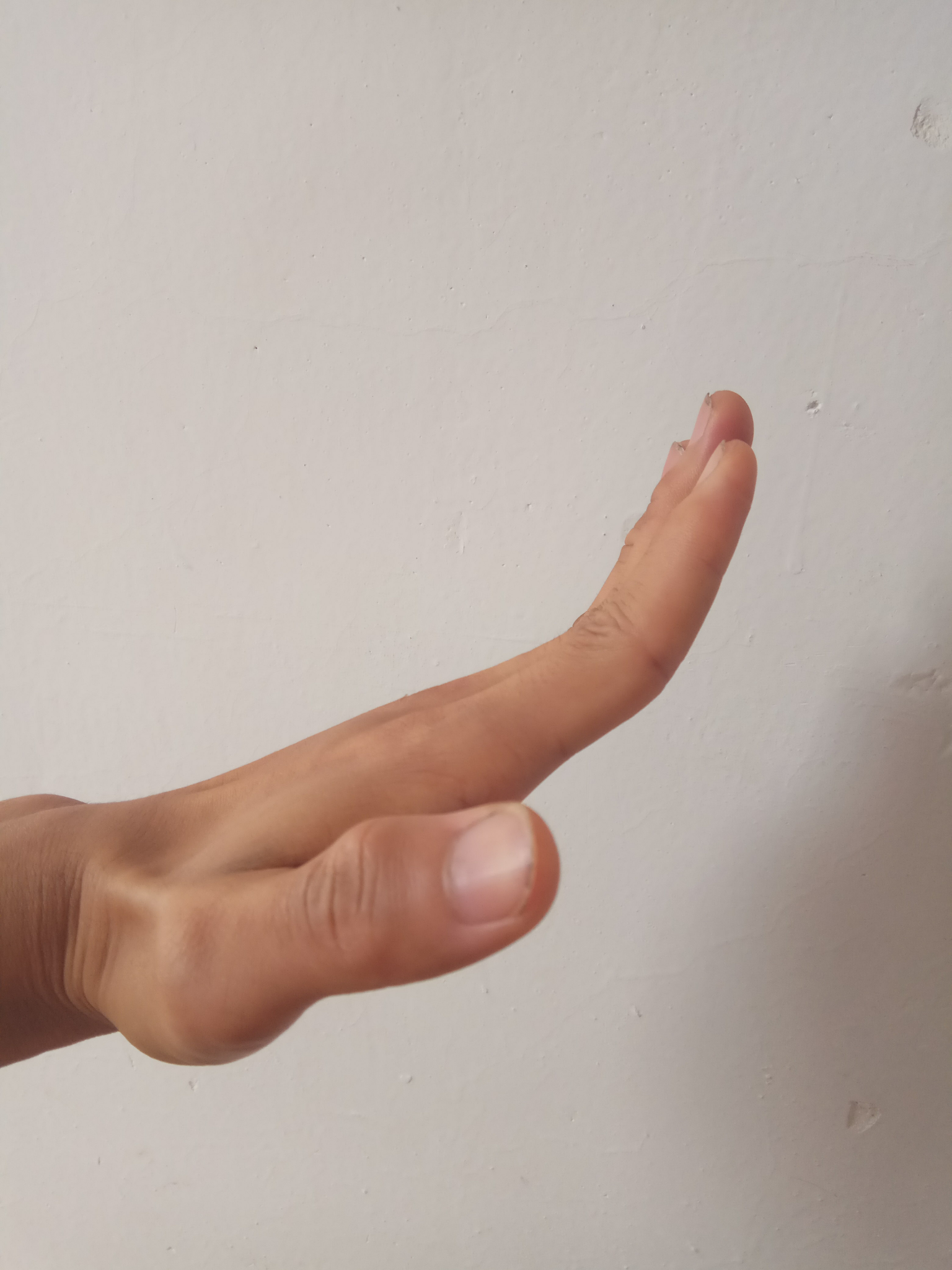 为什么我的手指伸不直