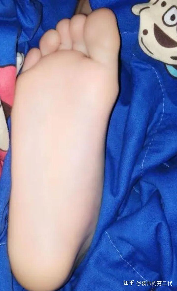 男孩脚底照片有什么问题吗? - 知乎