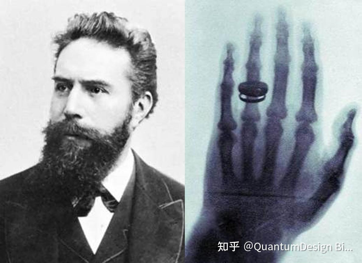 台式软X射线显微镜，摆脱同步辐射束缚，透视生命奥秘！ - 知乎