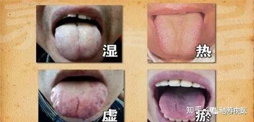 中医舌诊口诀!建议收藏! - 知乎