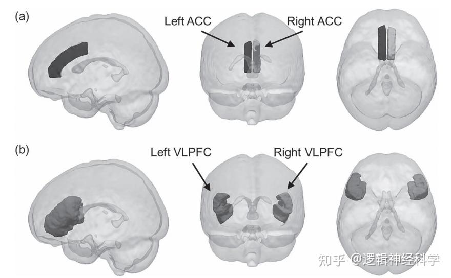 Cereb Cortex︱深圳大学何振宏实验室发现孤独感预测重度抑郁症患者前扣带回和右腹外侧前额叶灰质体积萎缩 - 知乎