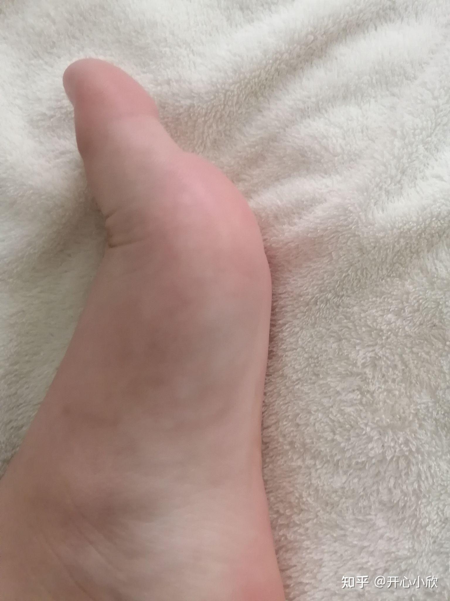 真的有女生是34码的脚吗