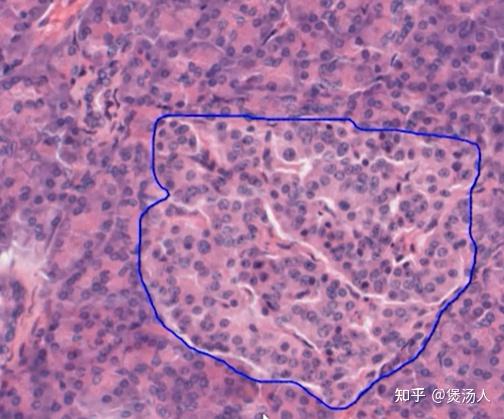 胰腺外分泌部he染色 腺细胞 呈锥体形,细胞底部位于基膜上,基膜酉腺