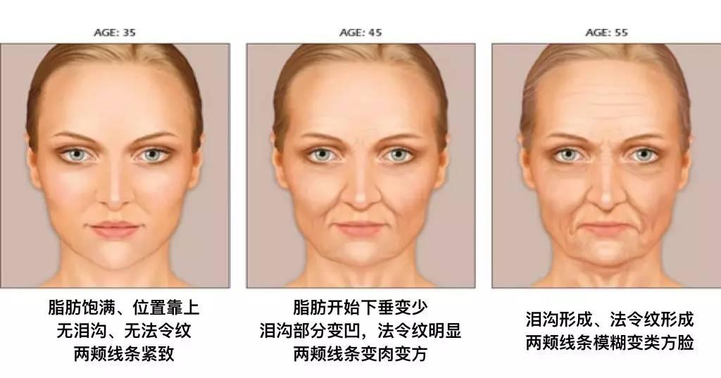 为什么我的苹果肌之间会有断层