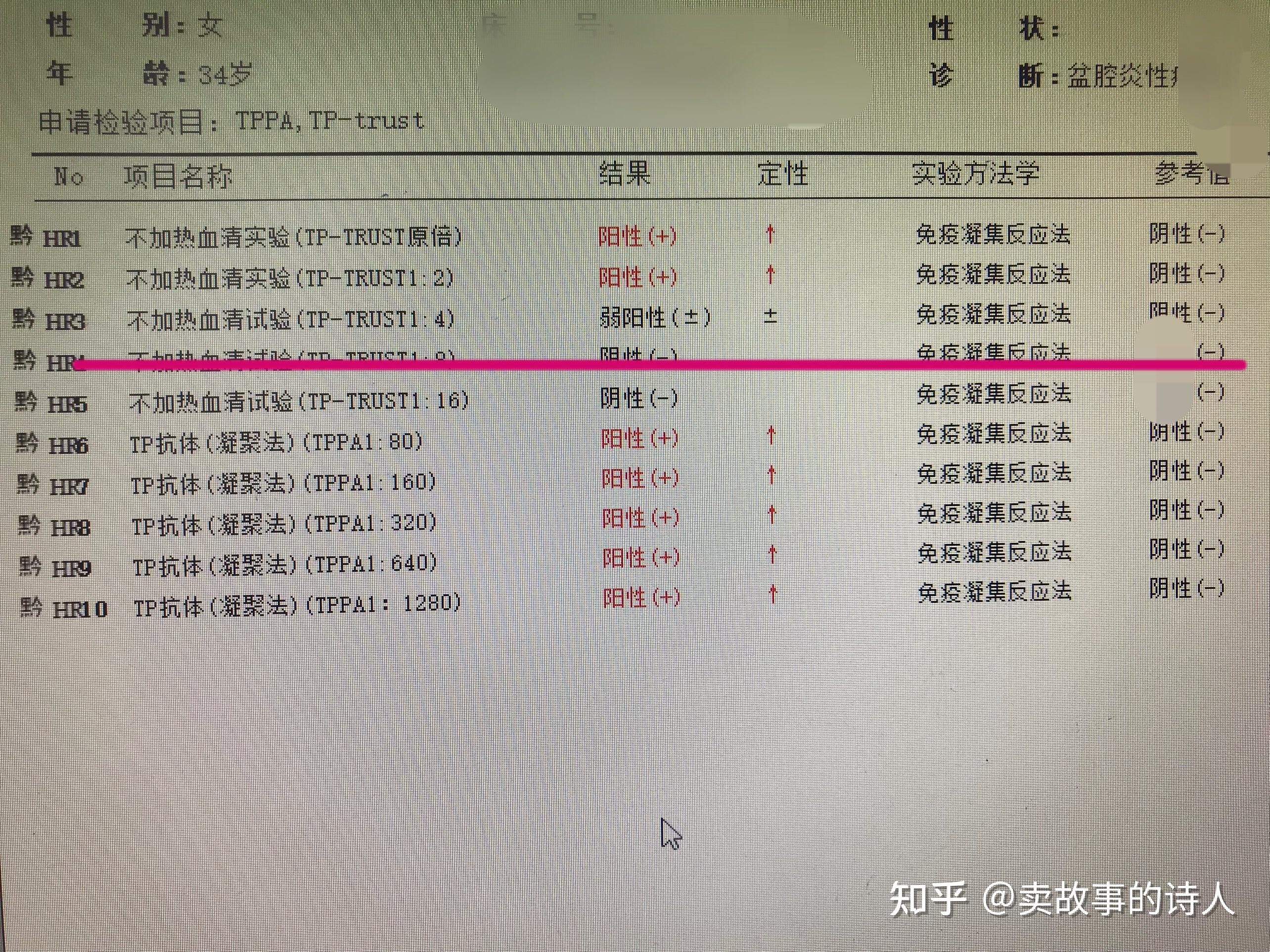 tppa1:80什么情况? - 知乎