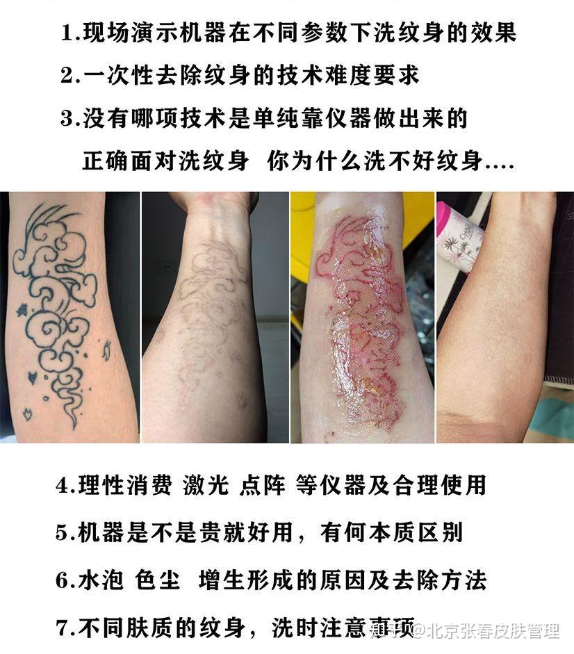 纹身可以洗掉吗