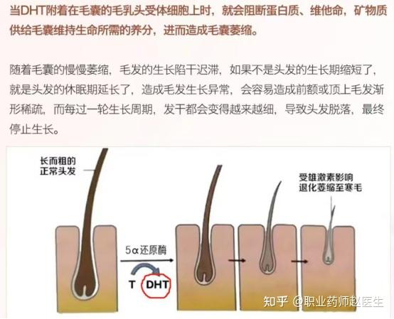 为什么会掉头发女生为什么在线