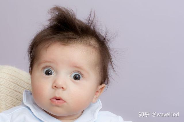 两侧额角和头顶最早脱发的真正原因 - 知乎