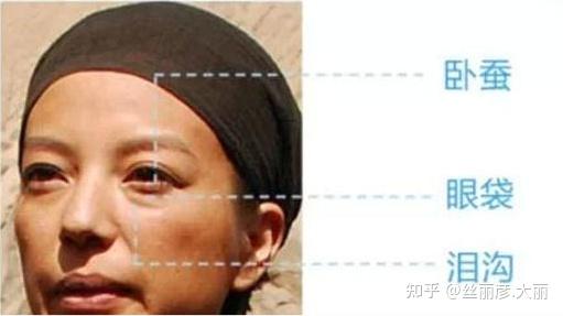 泪沟填充注意一下三点[不馒化更自然] - 知乎