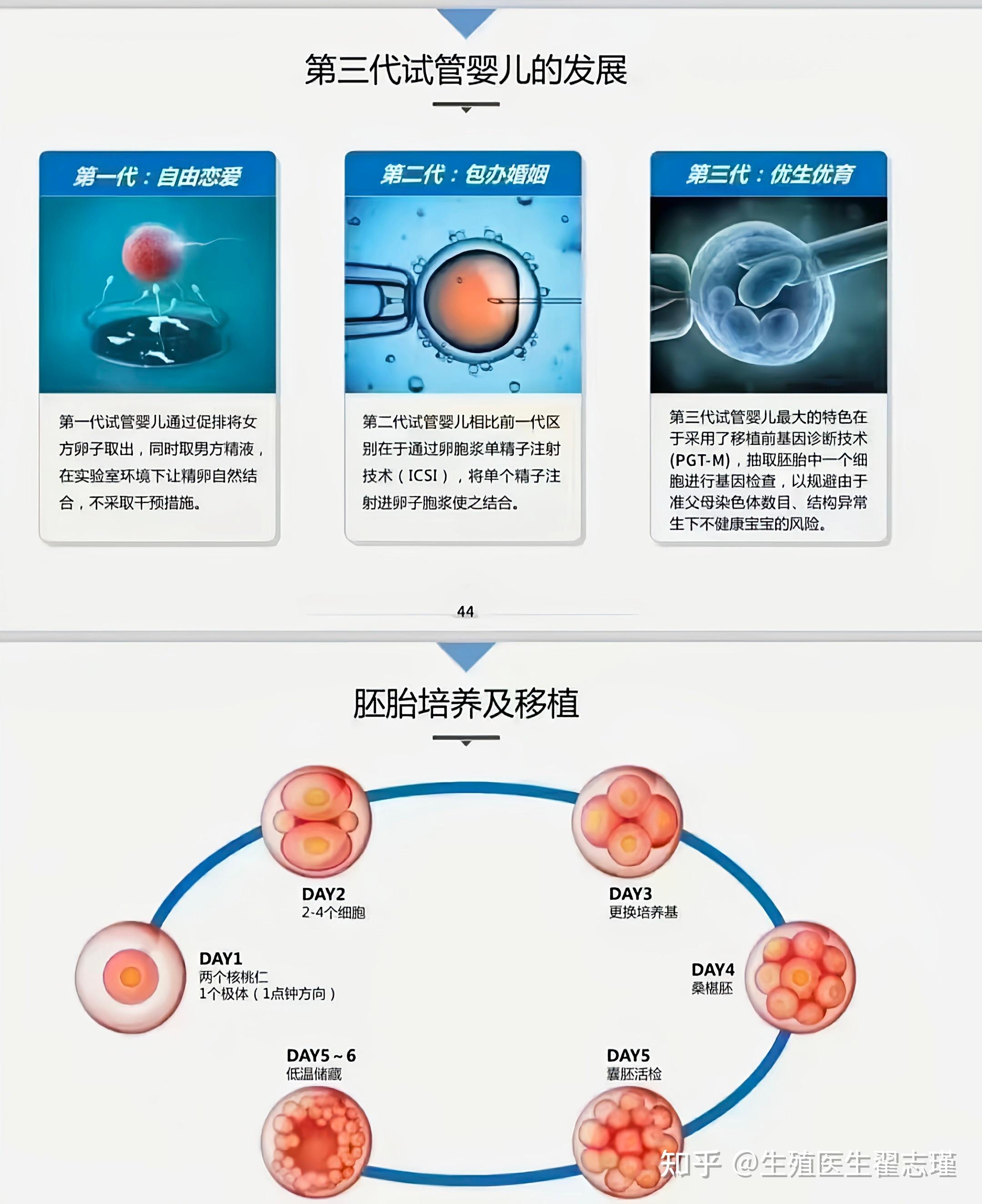 试管几代能选儿子