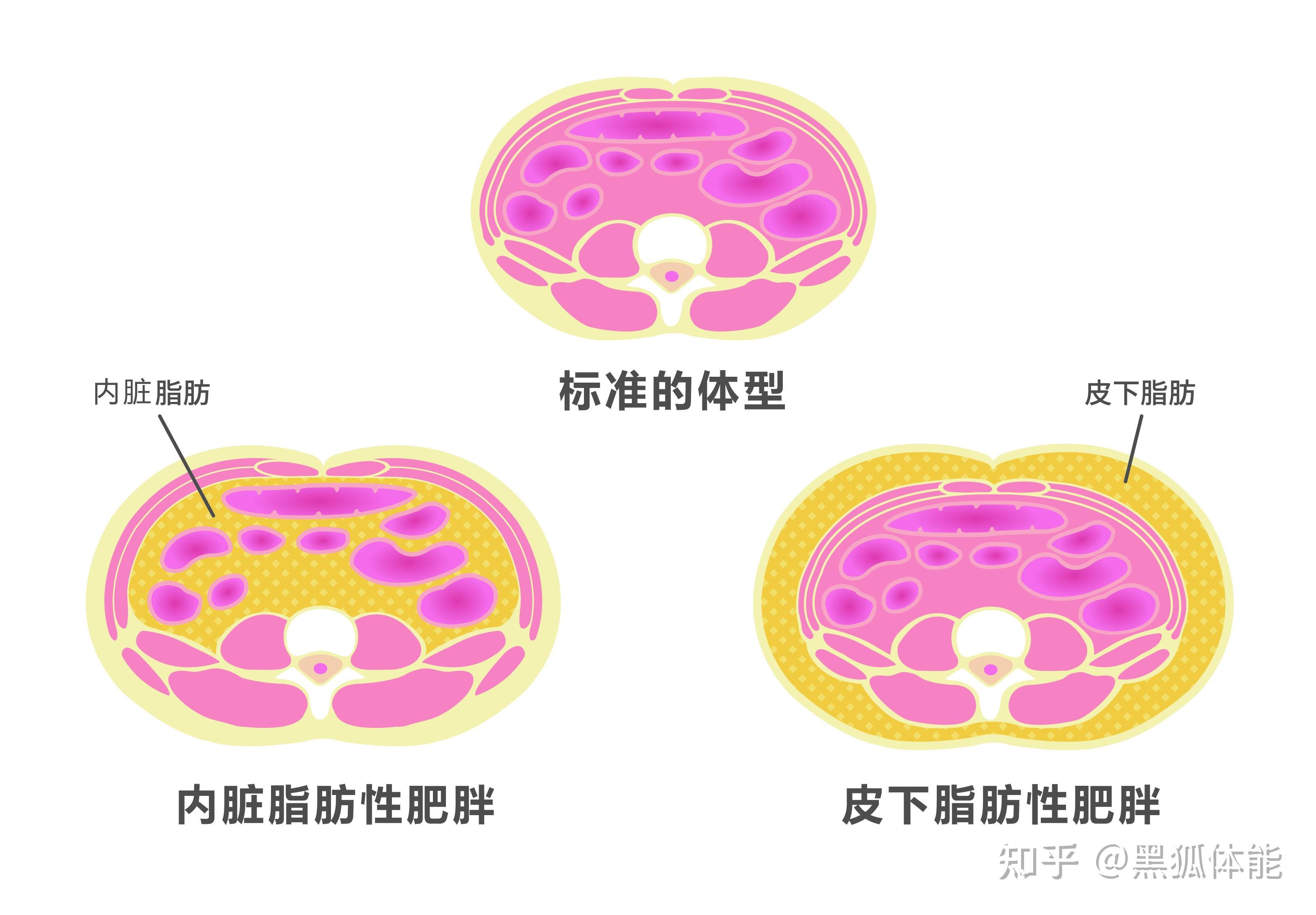 皮下脂肪 vs 内脏脂肪