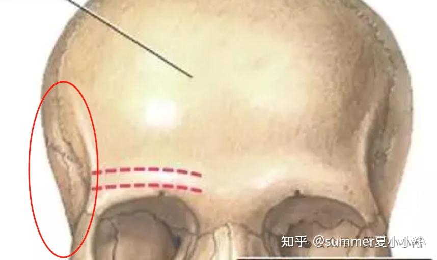 “颞部审美”是颜值新焦虑还是美人门槛? - 知乎