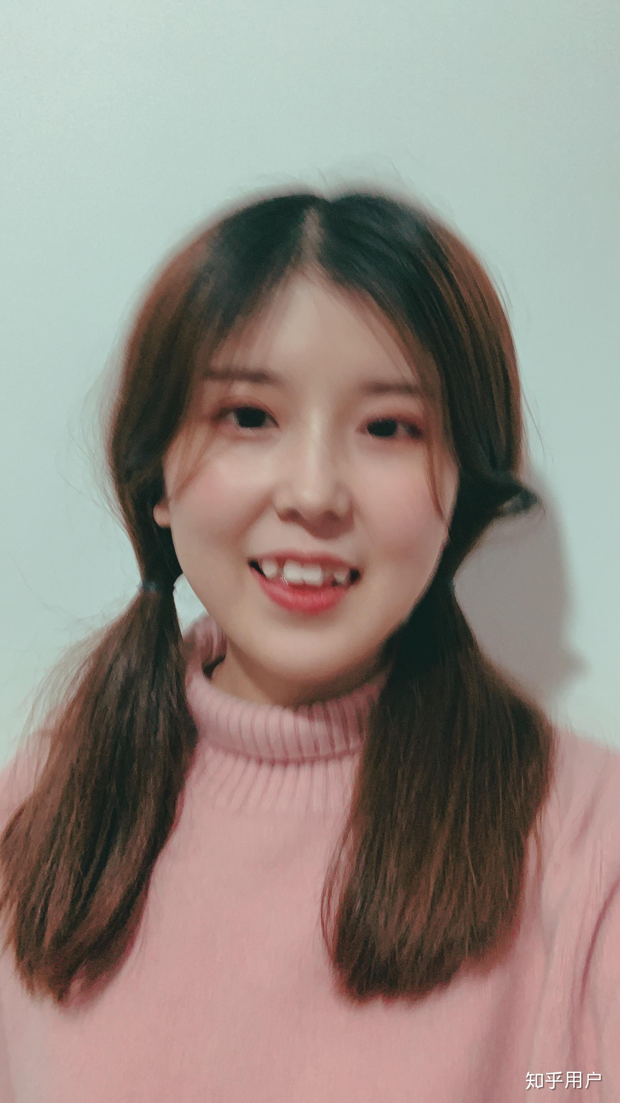 一个人同时长有虎牙和兔牙是什么样的感受