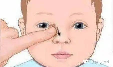 好端端地流眼泪很可能是泪道阻塞 - 知乎