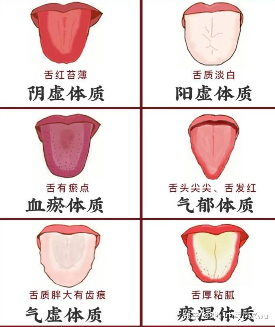 为什么中医只需要看看舌头就知道是什么病情 - 知乎