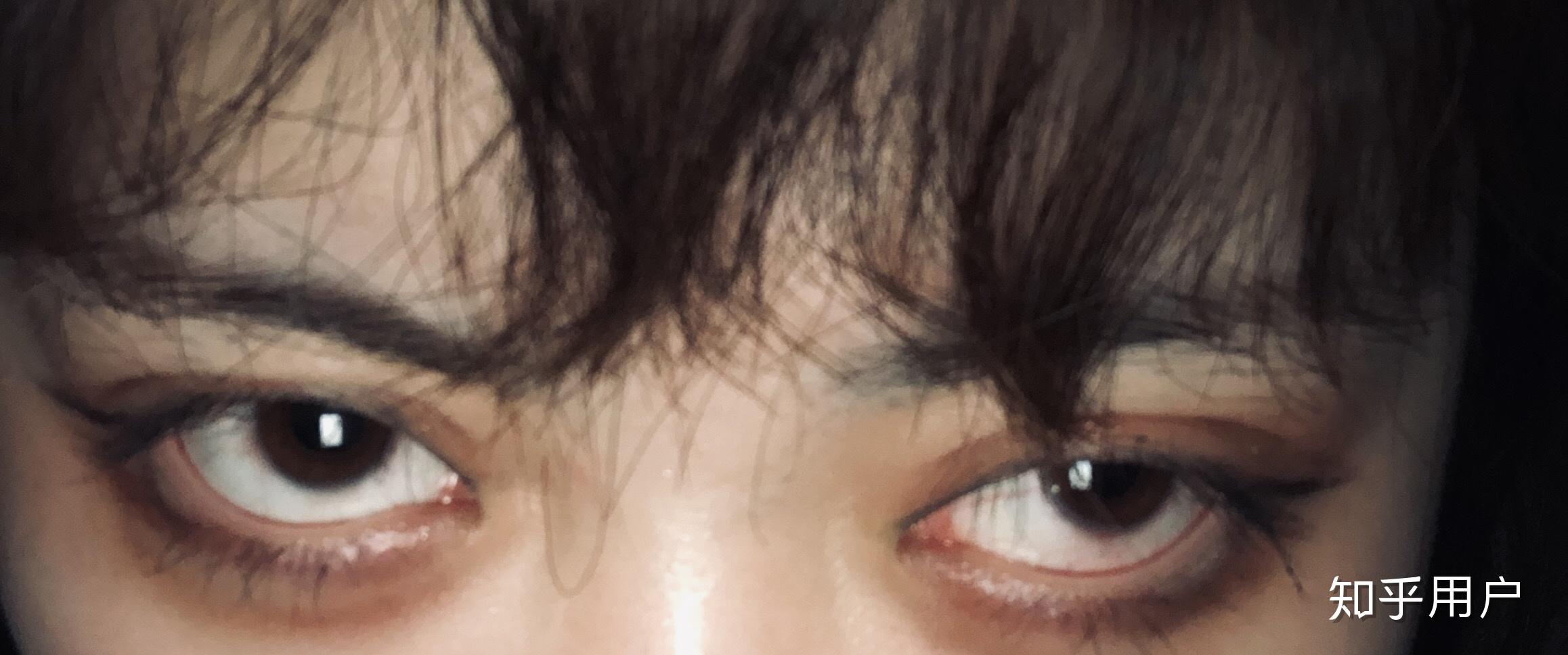 有一双死鱼眼是一种怎样的体验