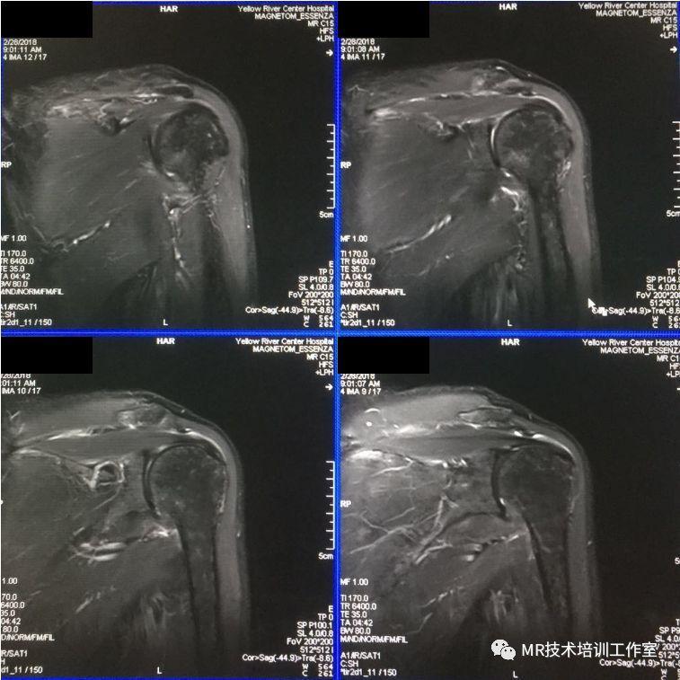 注意啦 来放射科检查mri 请把钱都掏出来 因为 知乎