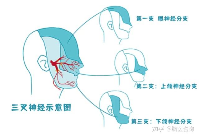 痛到怀疑人生?牙痛还是三叉神经痛,你得分清楚! - 知乎