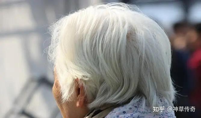 神草传奇养发馆:人为什么要长白发,白发的克星你知道吗? - 知乎