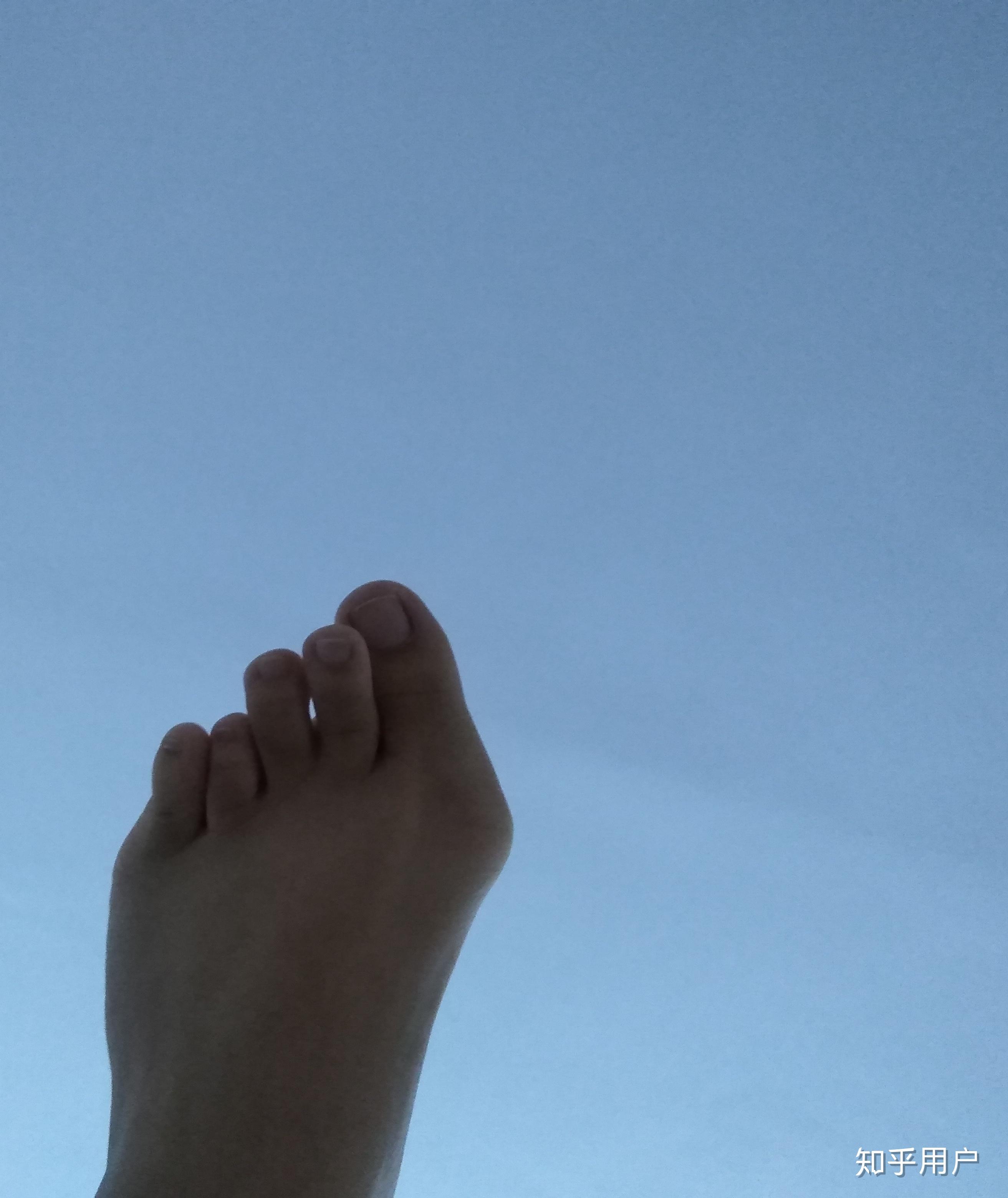 女生脚丑是种什么样的体验