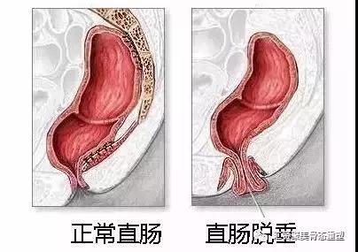 v2-ce413983da27cb3736a5debdfa027b9b_1440w.jpg?source=172ae18b