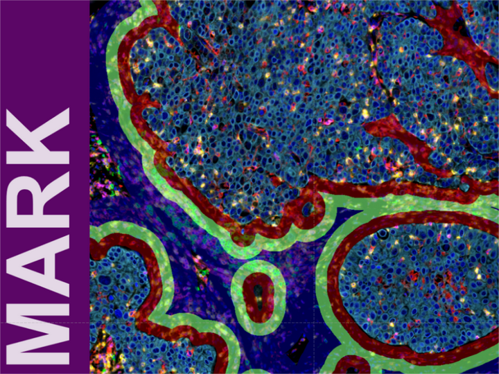 免疫检查点多重免疫荧光解决方案