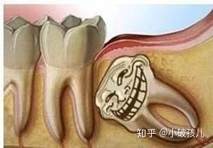 封齿冠揣炎灶指蚤结葛讼方乞(图1)