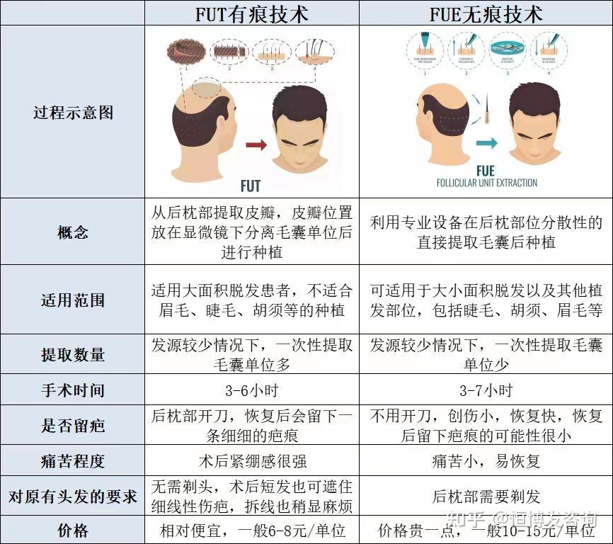 合肥头发种植全攻略:从毛发检测到术后养护,一次说清楚