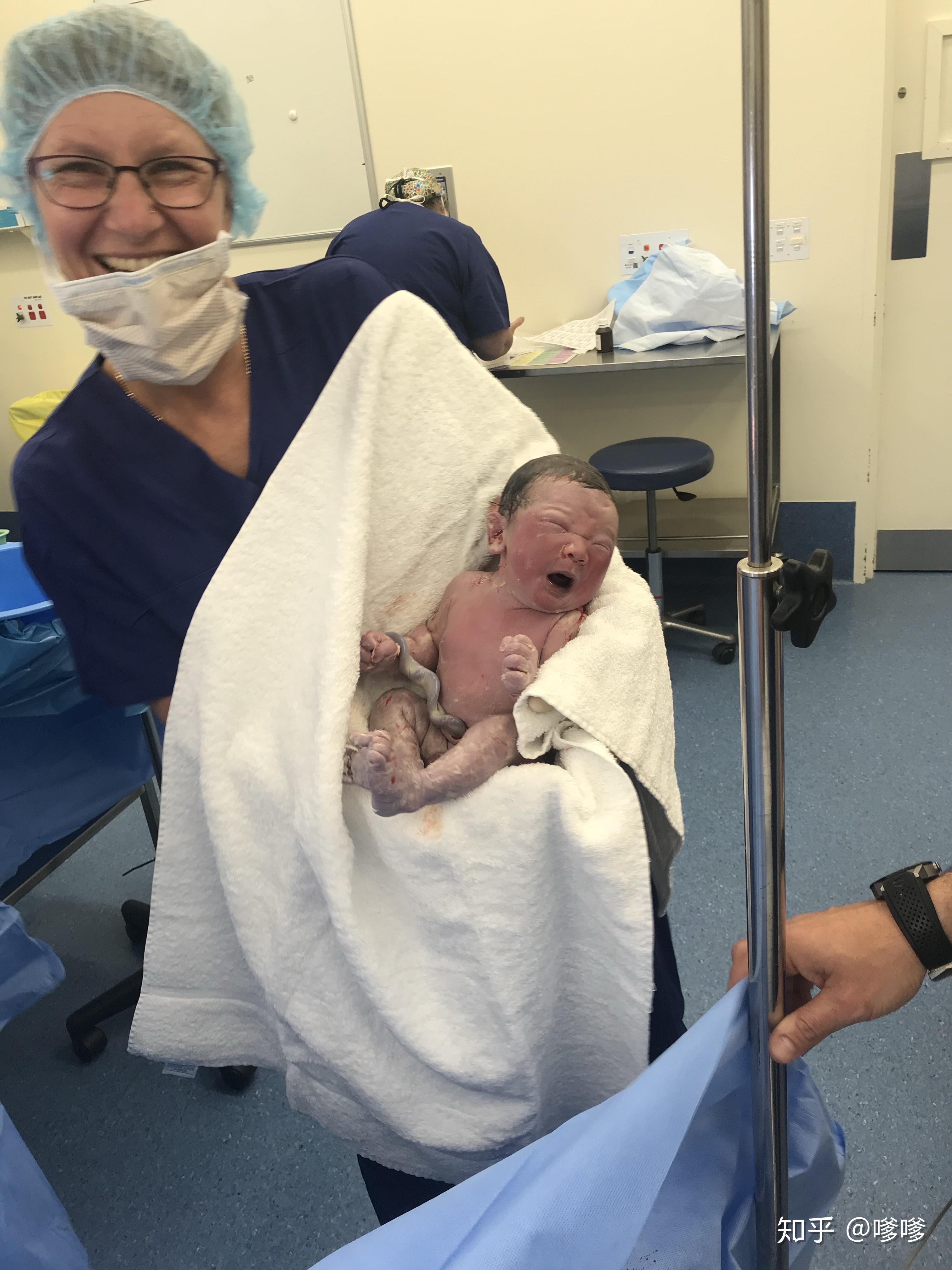 大家能晒一晒你们的宝宝婴儿时期的「丑照」吗?