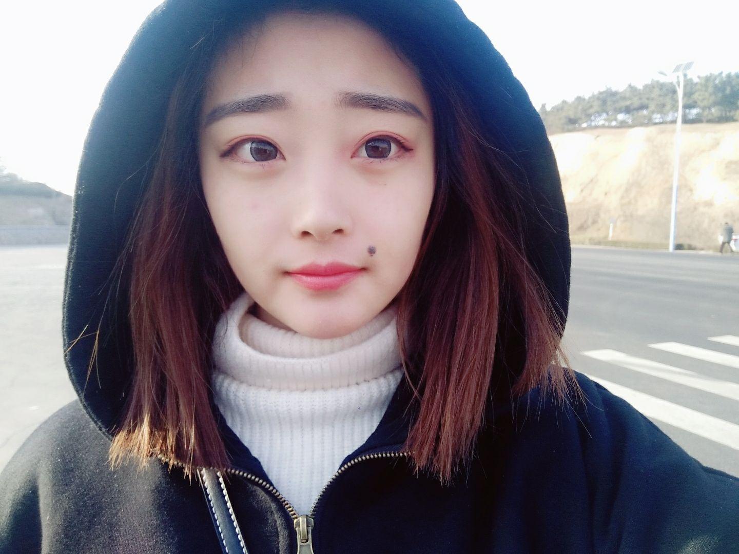 嘴角痣媒婆痣不知道到底取还是不取