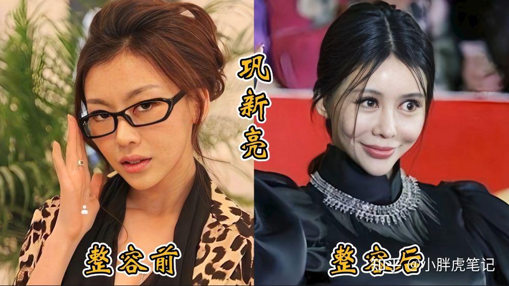 18位女明星整容前后对比，邵音音面目全非，杨颖堪称整容模板！ - 知乎