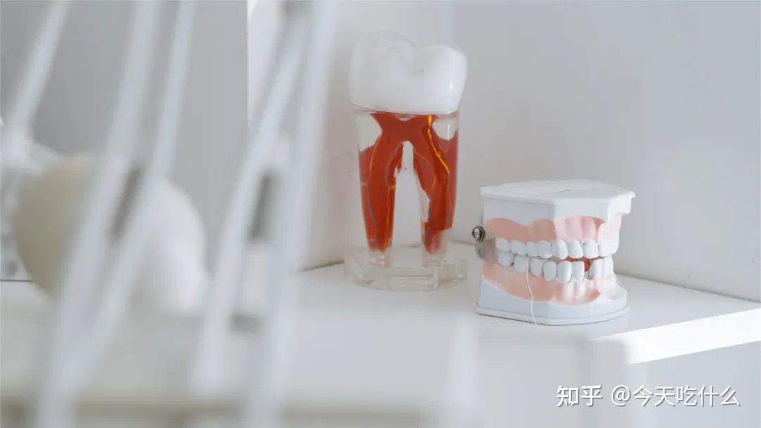 整牙小白看过来：超详细的正畸全流程，照着做不出错 - 知乎