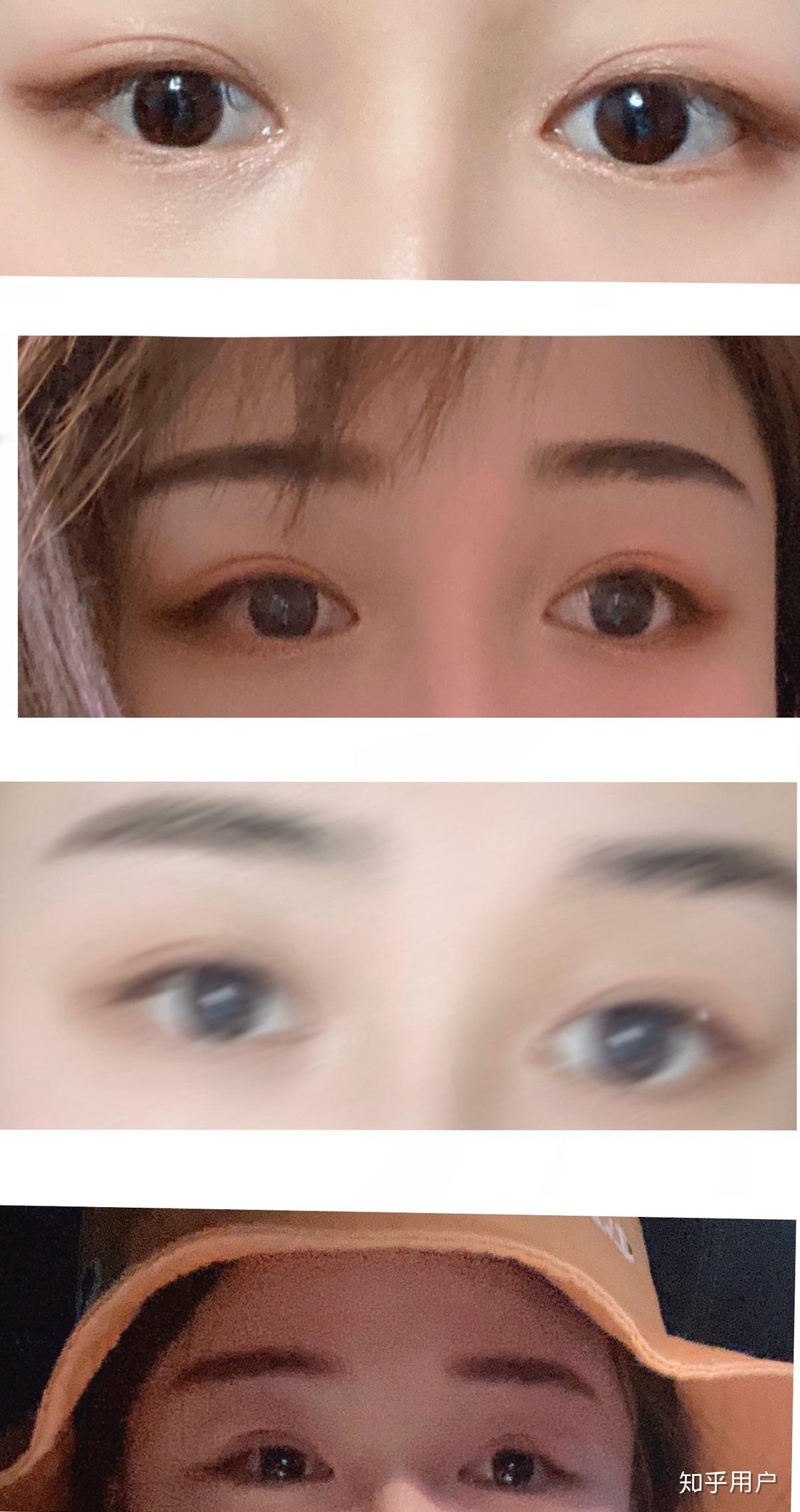 抑郁的人眼神都很空洞吗